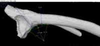 Ventral acetabular expansion and ilial shaft VSA.png